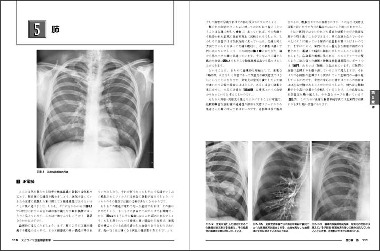 スクワイヤ放射線診断学 - 羊土社