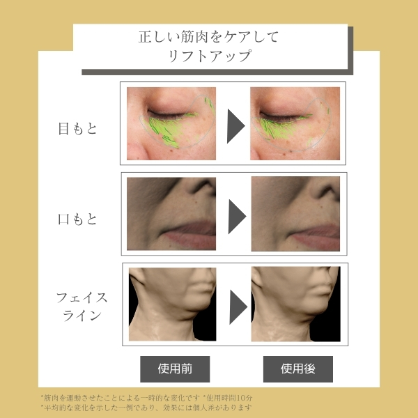 デザインリフトモア トータルリフト 4か月コース｜ヤーマン公式通販