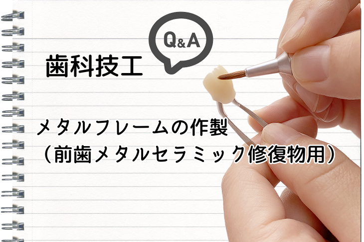 歯科技工Q&A】メタルフレームの製作（前歯メタルセラミック修復物用