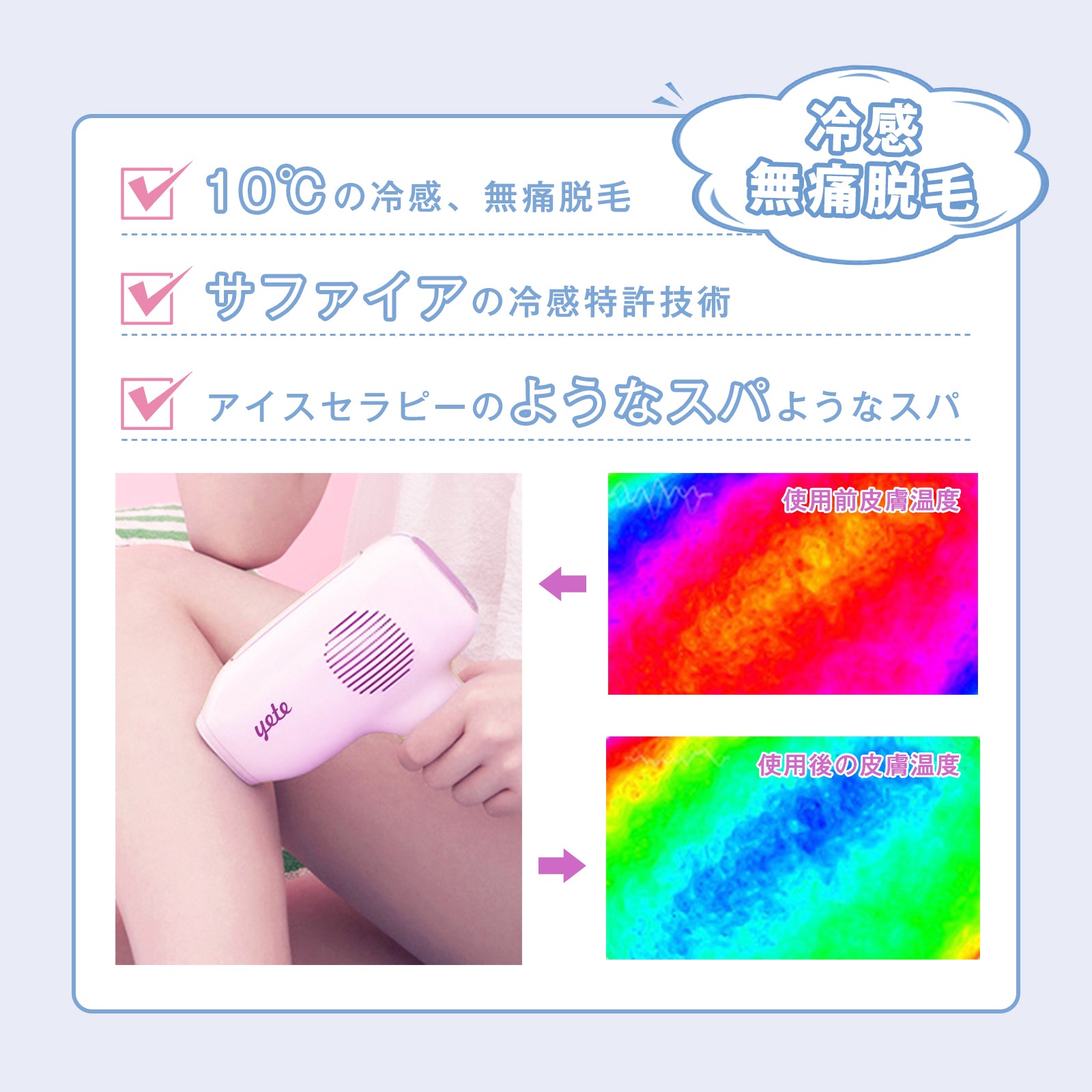 YETE 脱毛器 IPL光脱毛 家庭用脱毛器 冷感無痛ケア VIO対応