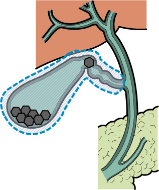 症状と治療法のご案内 | 外科・消化器外科 | 社会医療法人有隣会 東