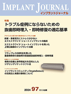 インプラントジャーナル IMPLANT JOURNAL 97号 | ゼニス出版