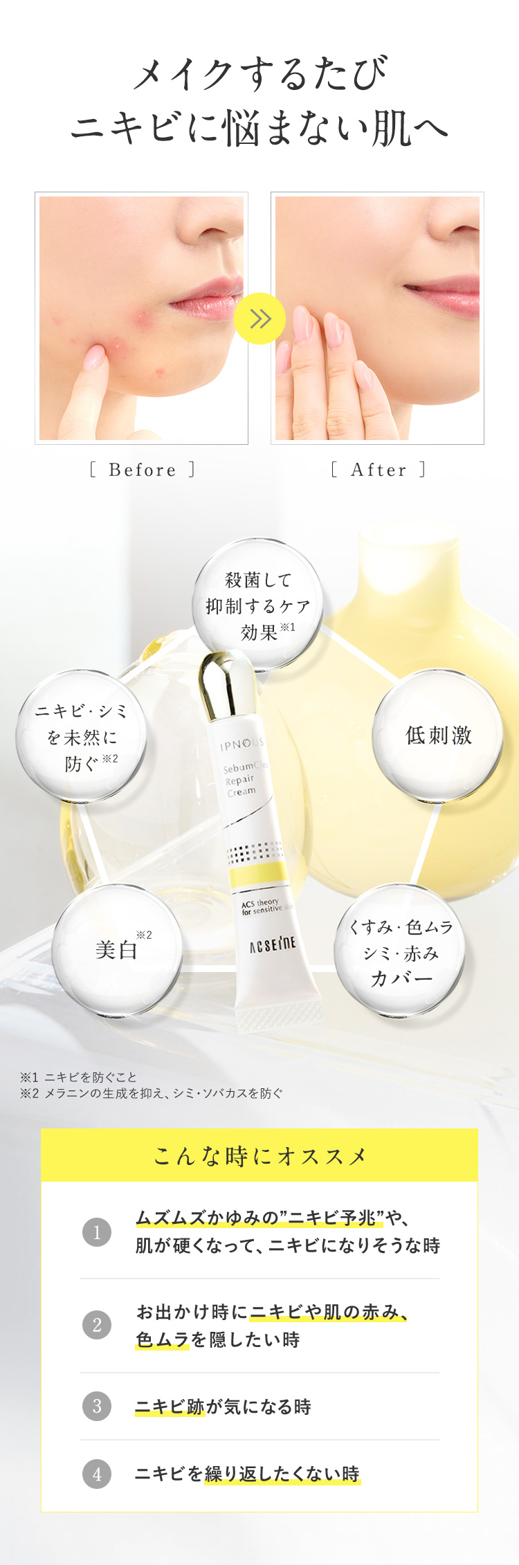 敏感肌に向き合うアクセーヌが開発 隠しながらニキビケアも美白も