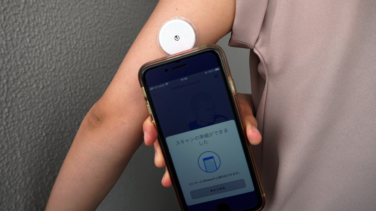 センサーで血糖値の変動を記録してみた、ビール1杯よりおにぎり2個で