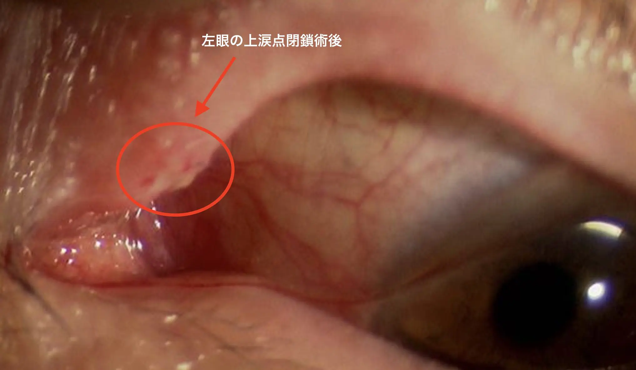 ドライアイ Dry eye | 医療法人社団有慶会 横浜井土ヶ谷アイクリニック
