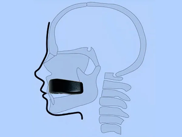 さつま式マウスピース」で睡眠向上も小顔も手に入れよう！ | さつま
