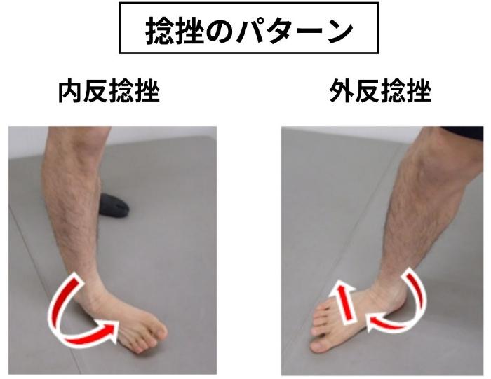 足関節捻挫 | ぜんしん整形外科 立川スポーツリハビリクリニック