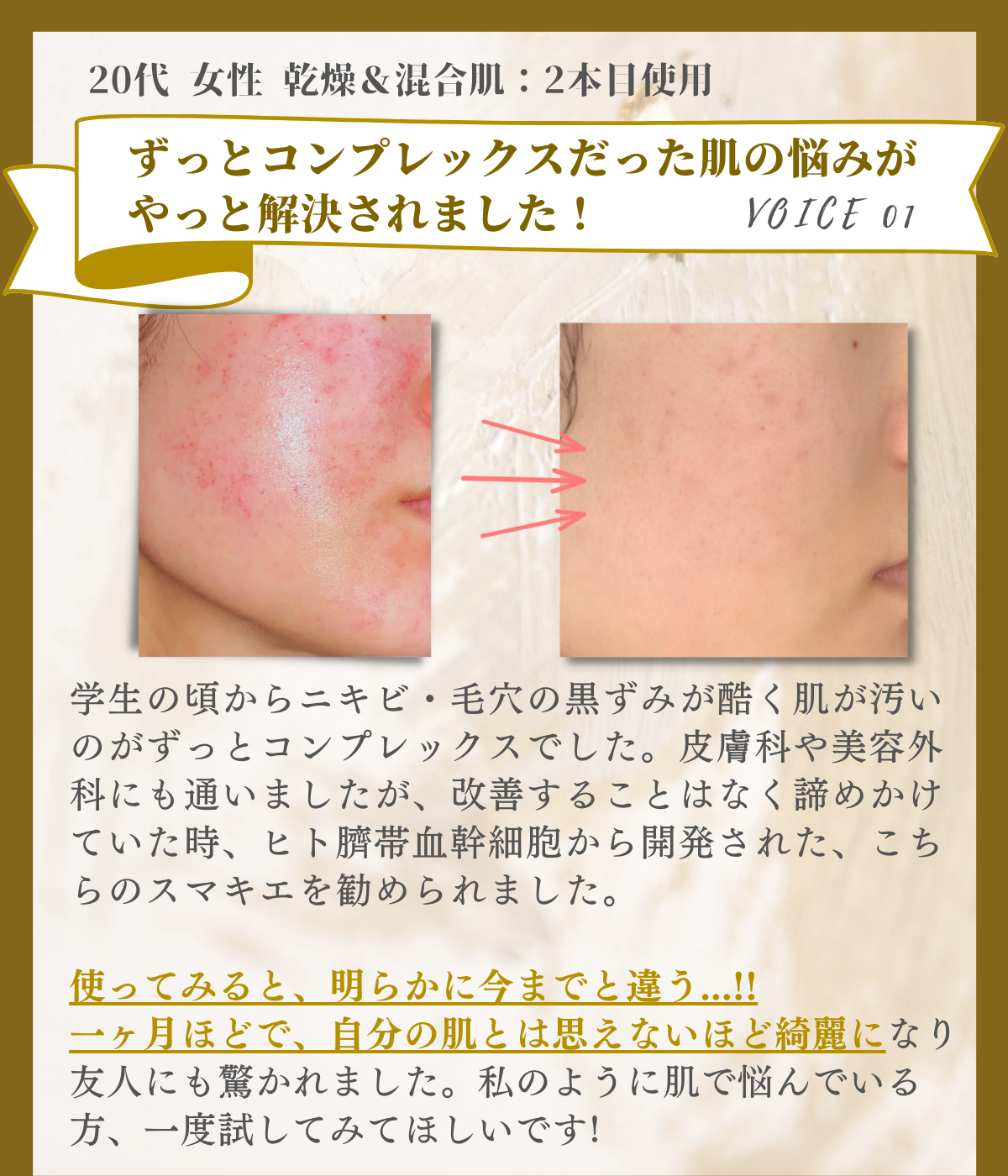 SUMAKIE スマキエセラム【公式】ヒト臍帯血美容液 | [ZELE PLUS