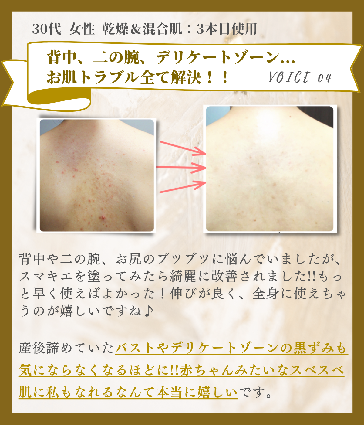 SUMAKIE スマキエセラム【公式】ヒト臍帯血美容液 | [ZELE PLUS