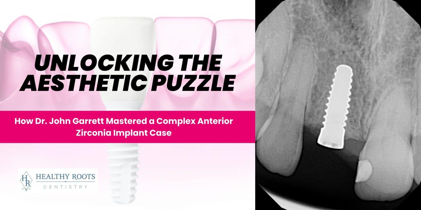 Unlocking the Aesthetic Puzzle: How Dr. John Garrett Mastered a