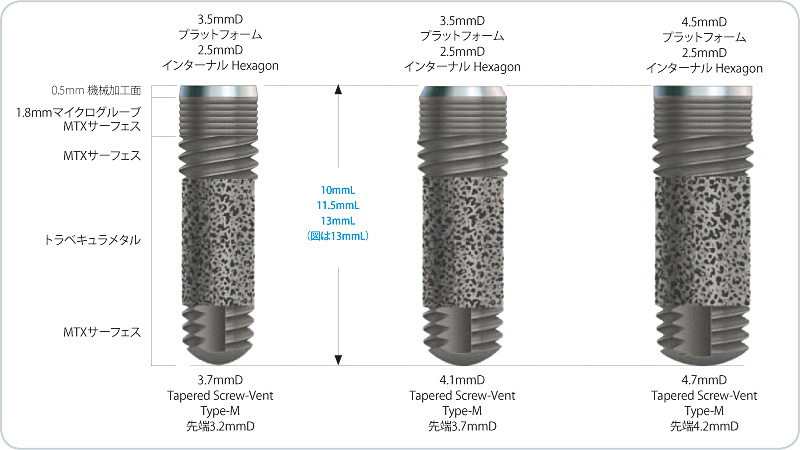 Trabecular Metal? Dental Implant｜インプラント｜ジンヴィ・ジャパン