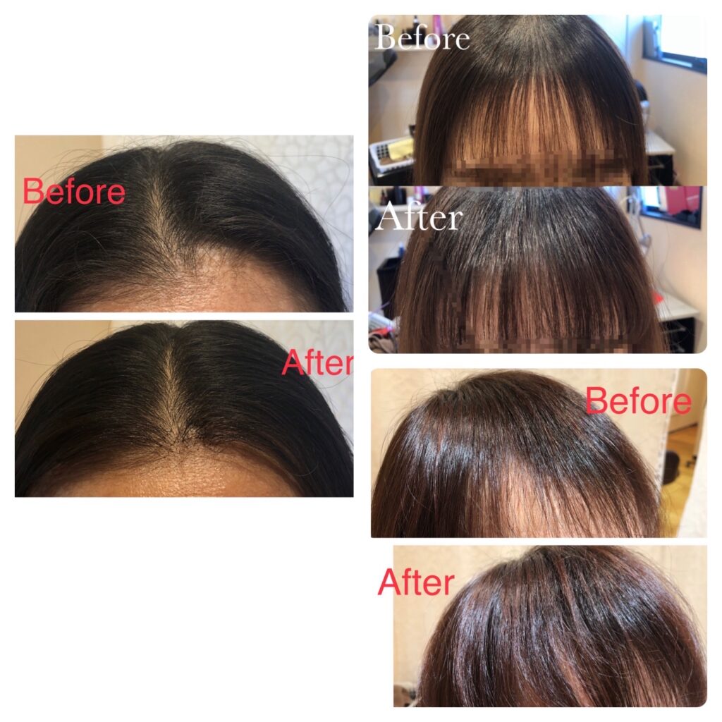 増毛技術者が教える」増毛と増毛エクステの種類を徹底解説 | 福島県