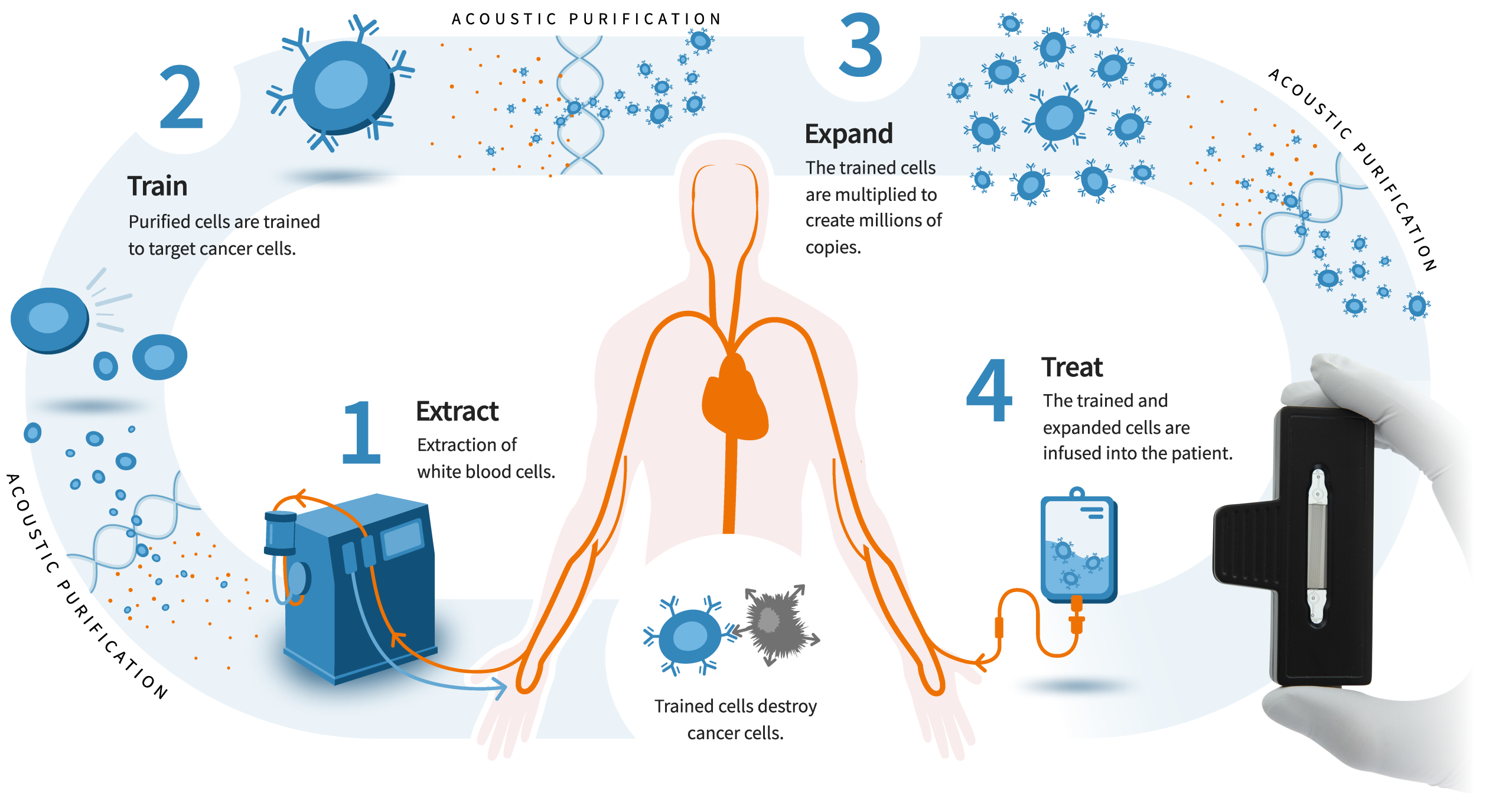 Cell Therapy - Acousort