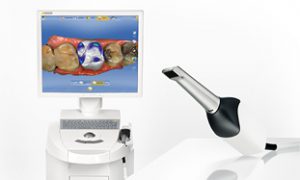 CEREC（セレック）の特徴 | CAD/CAM総合情報サイト Digital Dental academy