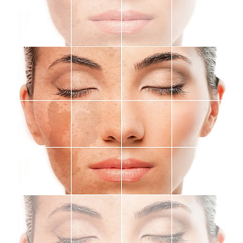 ABCビューティーオンラインショップ / ゼオスキンヘルス ミラミックス/80ml