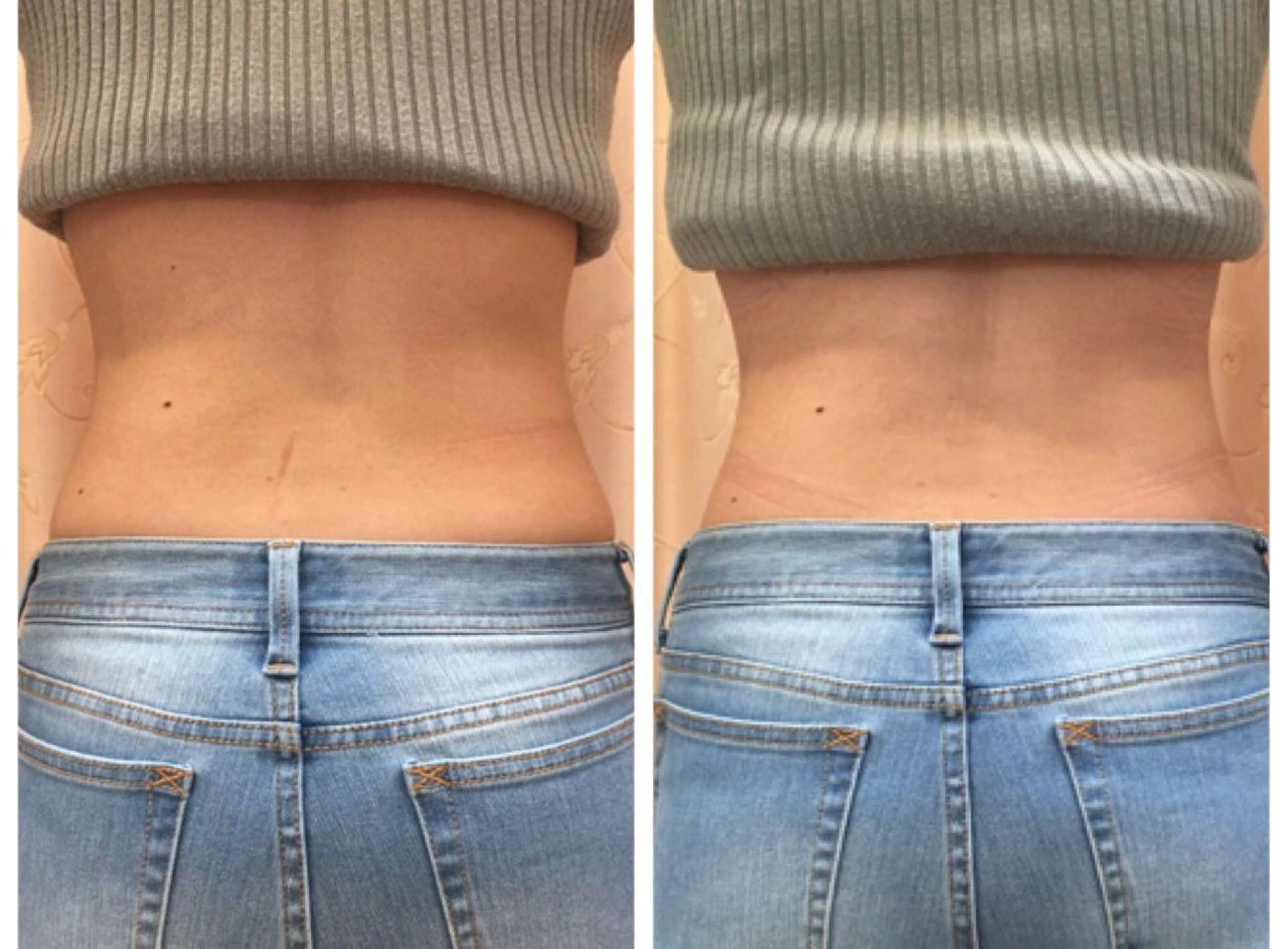 本気でポードランジェ！！ | 長野店 | メイキングランジェリー・補整