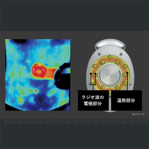 ヤーマン キャビスパプレステージ for Salon — 美容皮膚専門店 AOHAL365