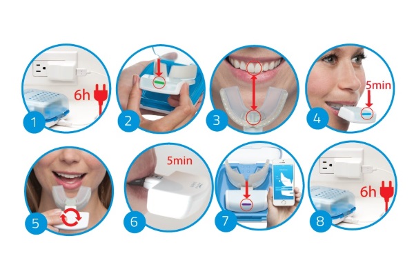 光加速治療「オーソパルス（オルソパルス）」 | 世田谷区二子玉川