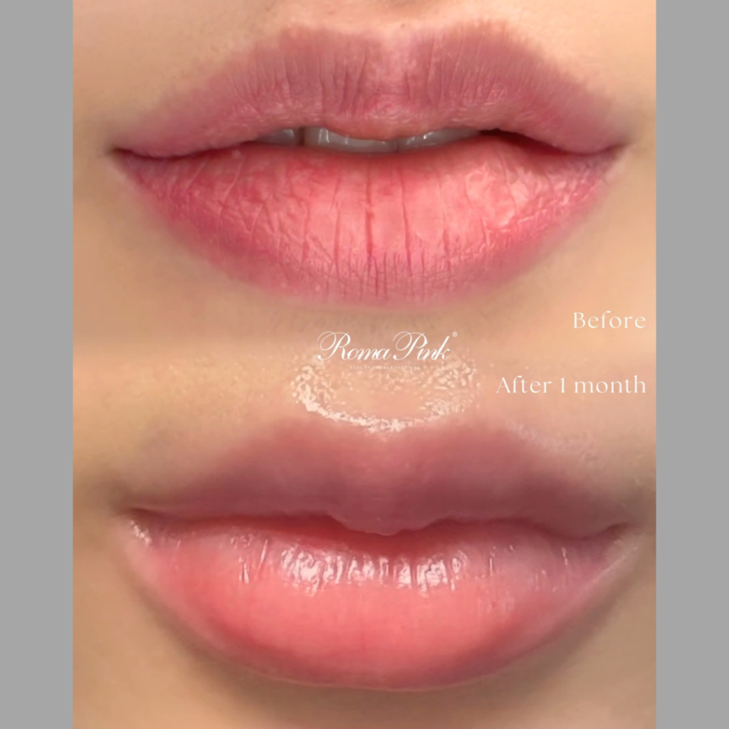 メラニンケア Roma Pink（ローマピンク）リップ＆ボディ | 愛媛県西条