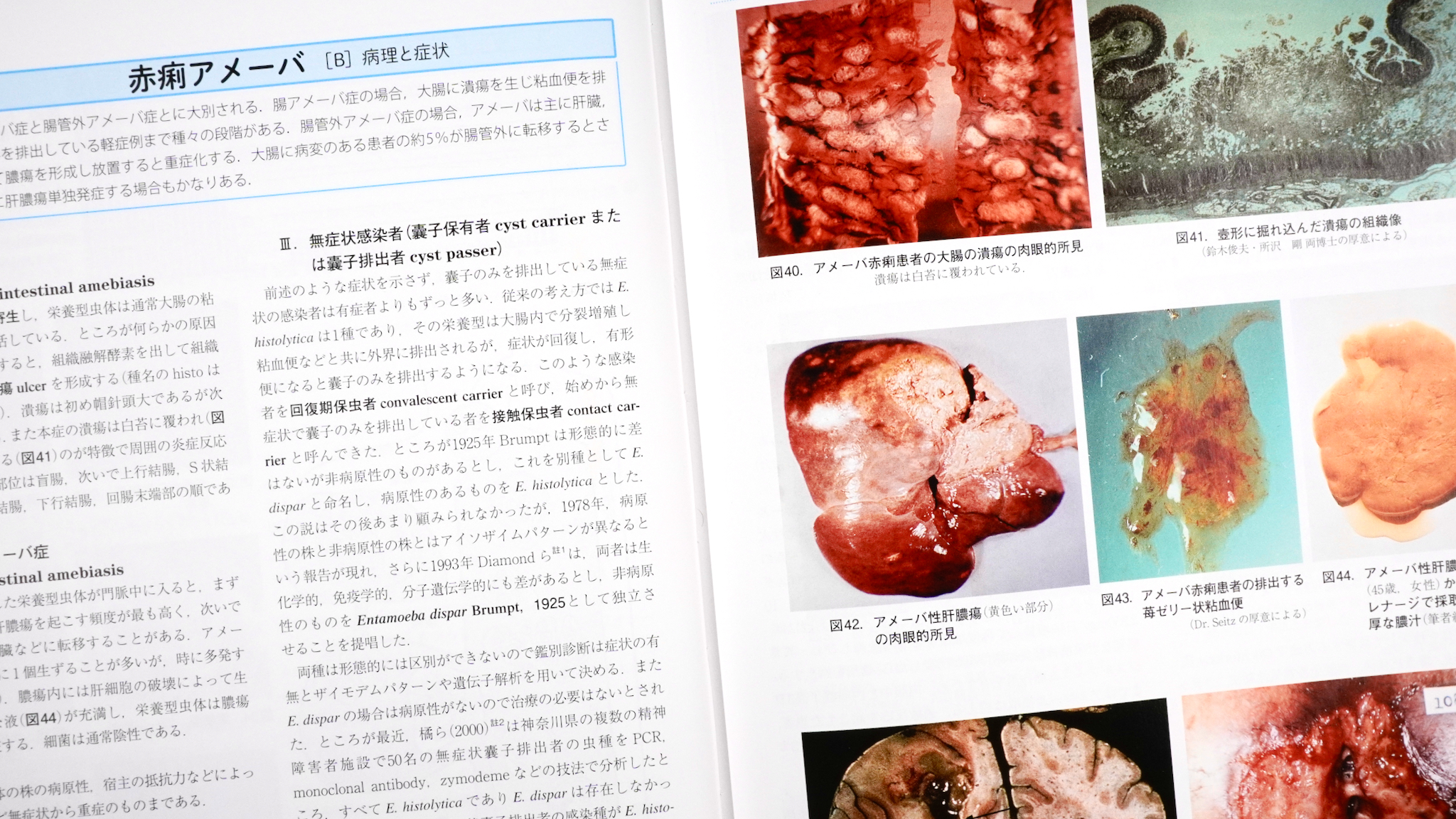 寄生虫を守りたい ／ 図説人体寄生虫学 第10版 / Anatomy 今日も明日も