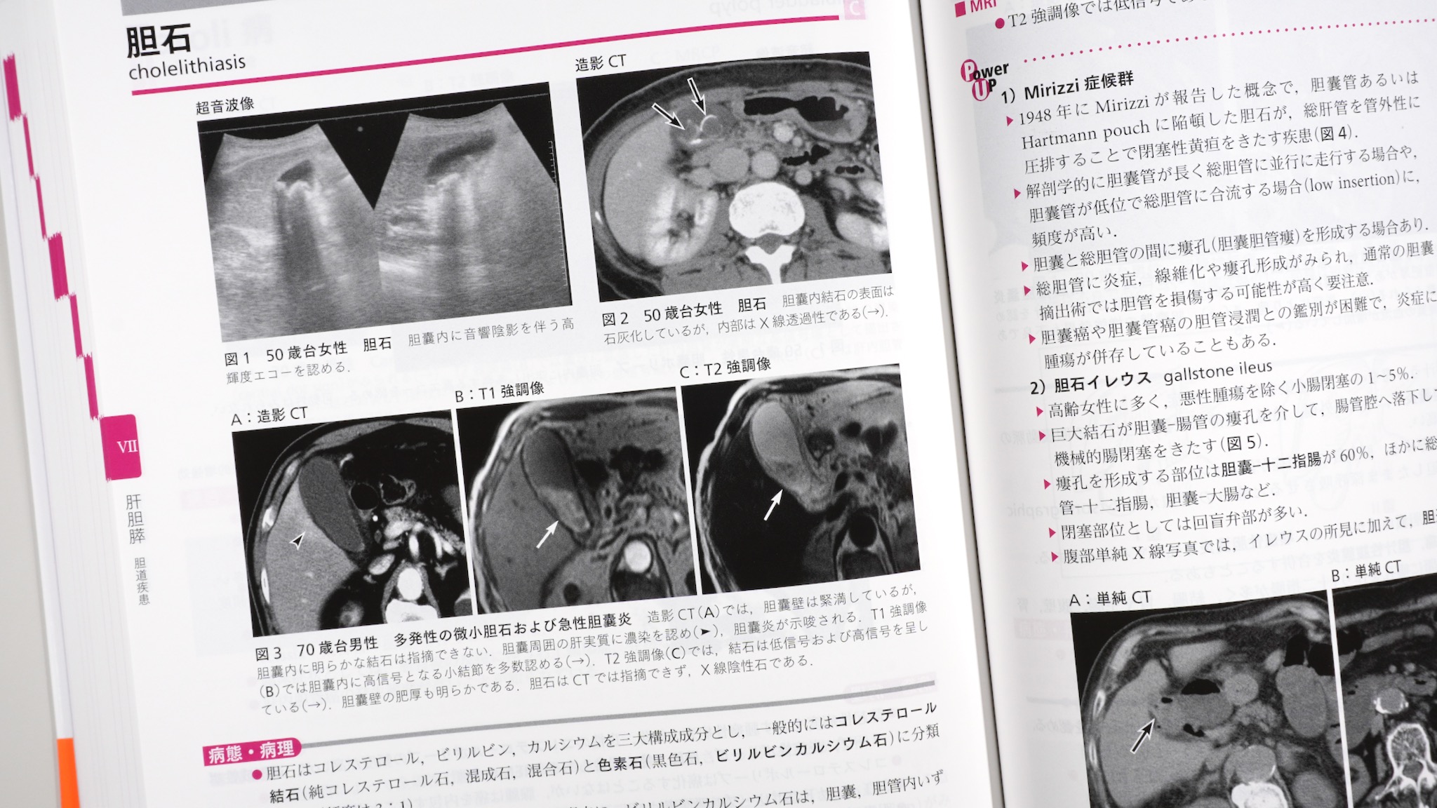 ジェネラリストを目指す人のための画像診断パワフルガイド 第2版