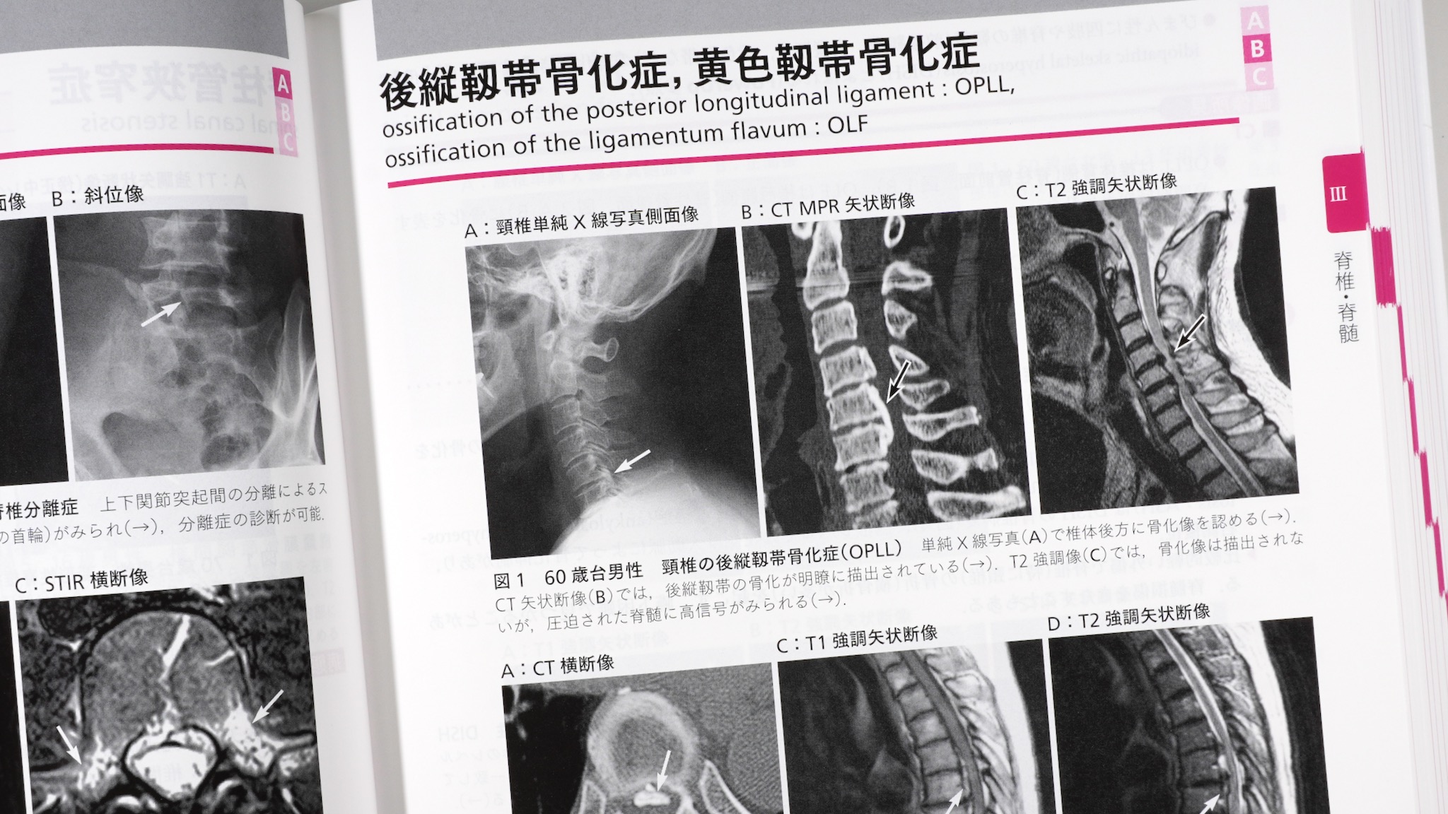 ジェネラリストを目指す人のための画像診断パワフルガイド 第2版