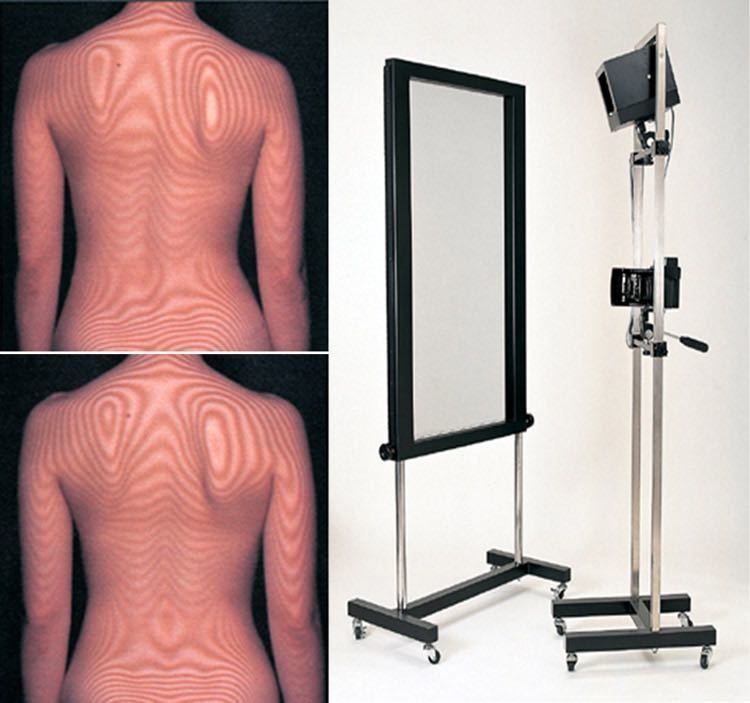 激安！モアレトポグラフィー モアレ 姿勢 分析 等高線 整体 歪みチェック