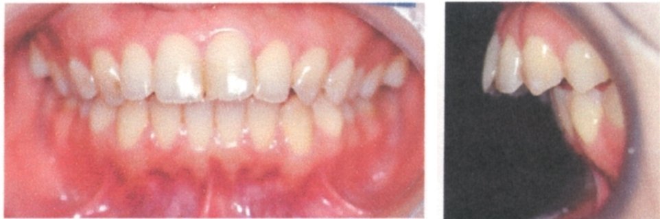 自分の歯列矯正に失敗した歯医者の私が20年かかってわかったこと｜ビバ亀升