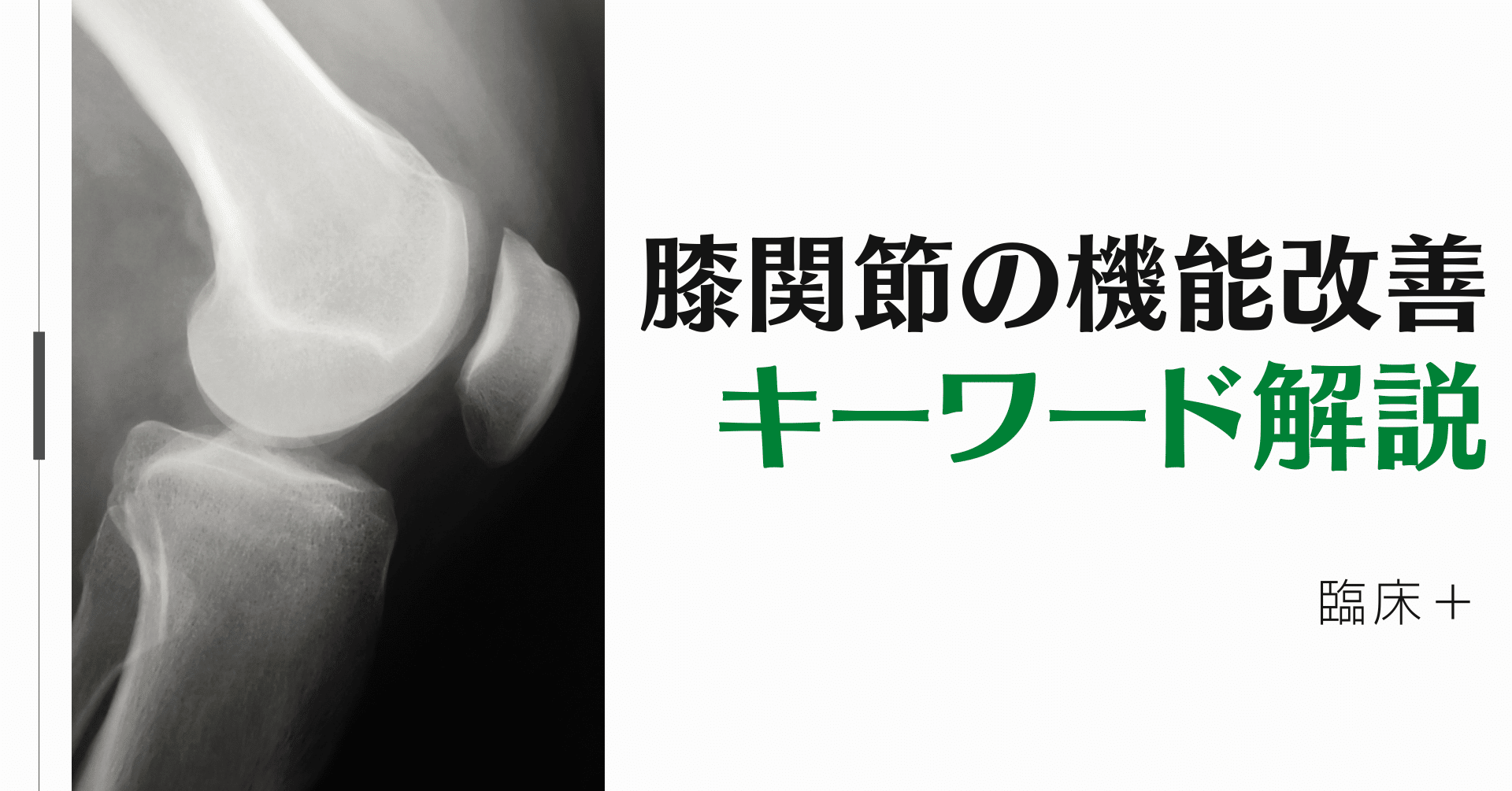 膝関節の再建法 最適な選択のために 膝関節の再建法−最適な選択のため