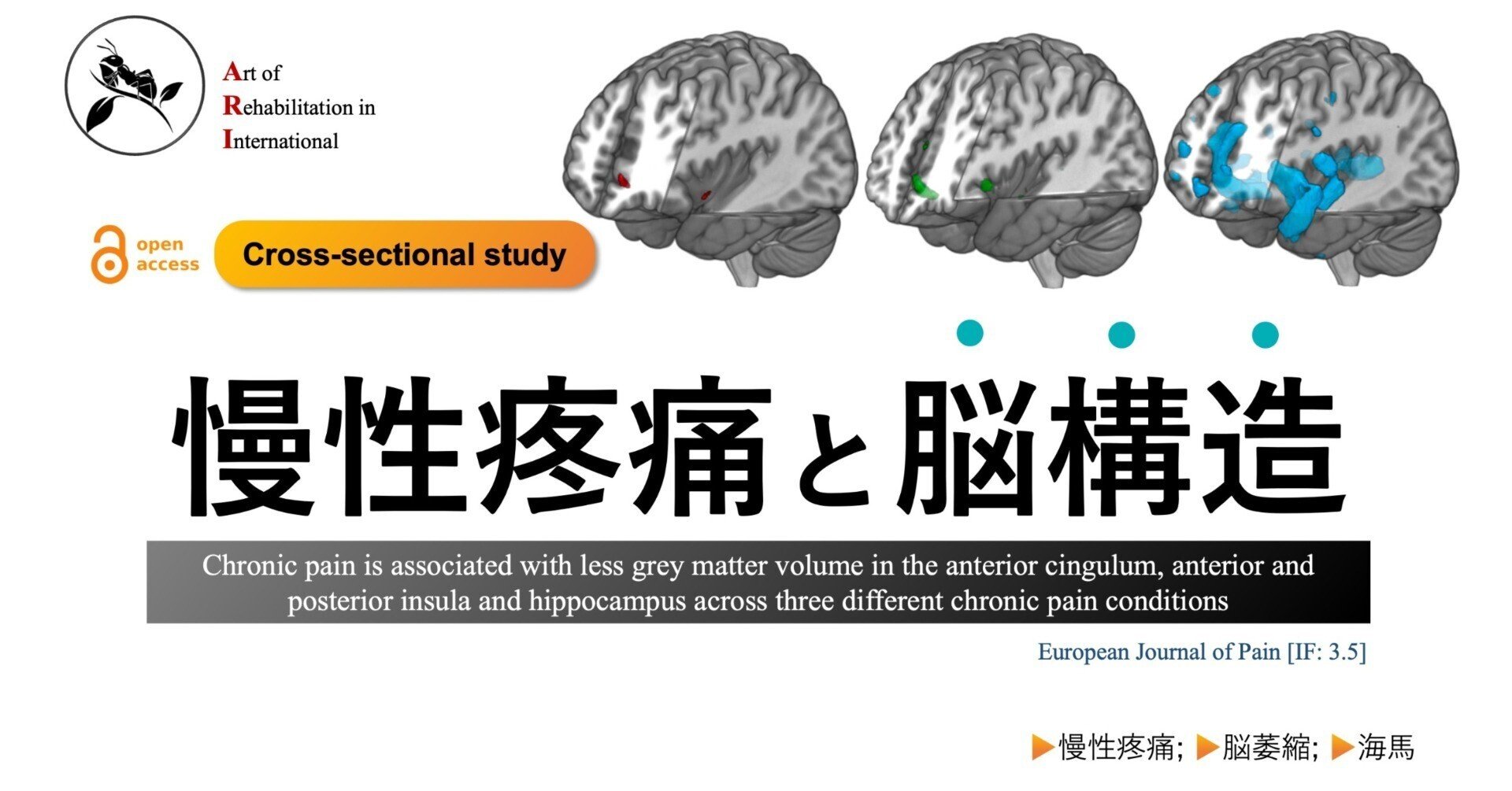 慢性疼痛と脳構造｜Super Human | 理学療法士／保健学博士 Ph.D.