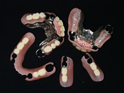 ノンクラスプデンチャー – 【公式】広島市の歯科技工所「株式会社