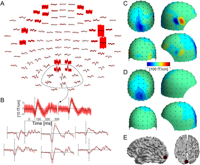 Automatic and robust noise suppression in EEG and MEG: The SOUND