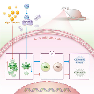 Icariin interacts with IGFBP3 to alleviate diabetic cataract