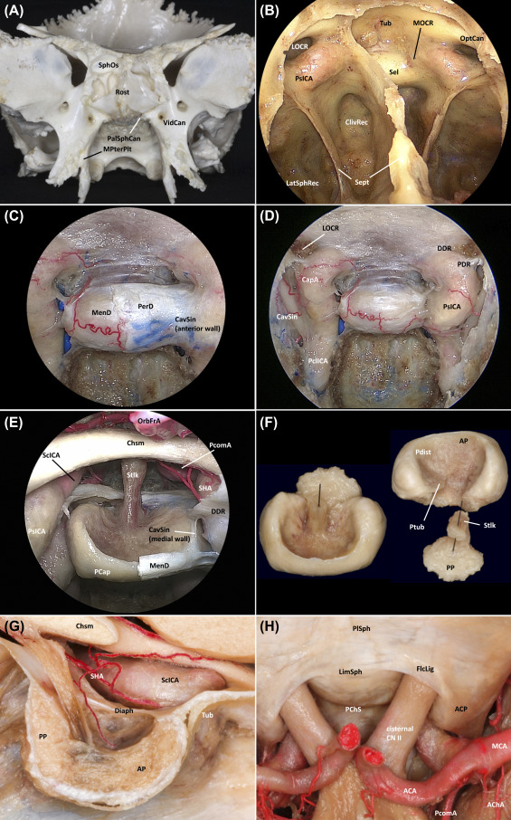 Surgical Anatomy of the Skull Base - ScienceDirect