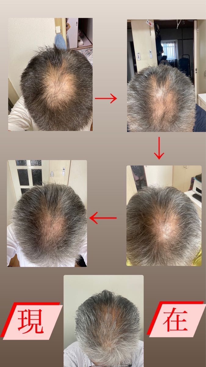 SUKUU MAHHA美顔器 ブラックorホワイト｜Yahoo!フリマ（旧PayPayフリマ）