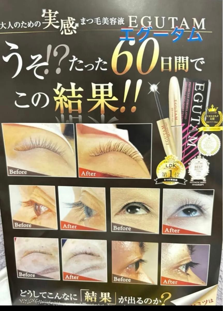 エグータム まつ毛 まゆ毛美容液 [正規品]｜Yahoo!フリマ（旧PayPay