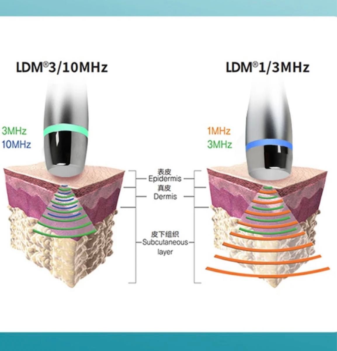 i-cool 水玉リフティング LDM SONOと同等マシン 韓国肌管理｜Yahoo