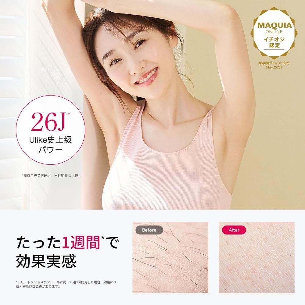 Ulike 脱毛器 Air10 光美容器 髭/脇/VIO/脚/腕 全身対応可能 週に3回で