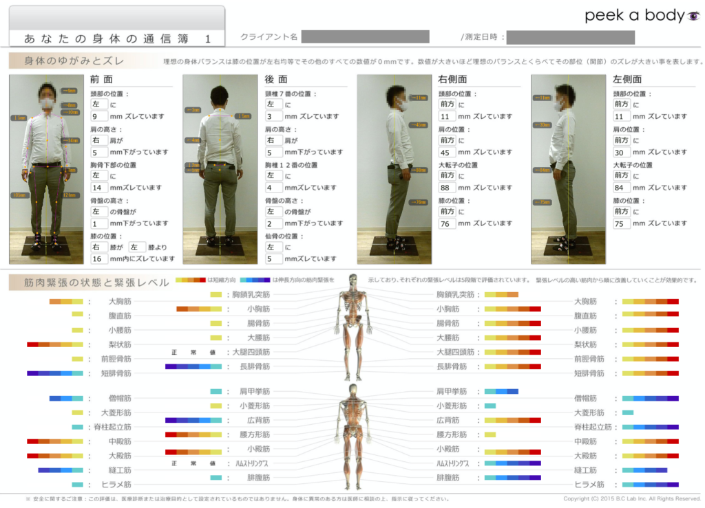 姿勢分析 | あずま整骨院