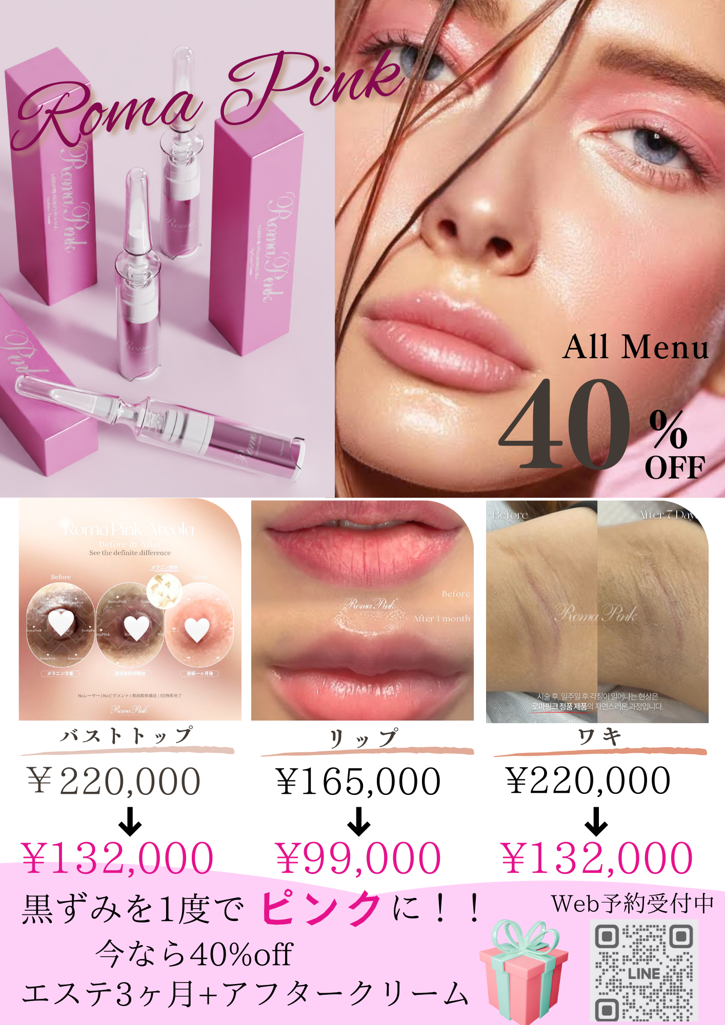 ローマピンクにプレゼント付♪ | 那覇市 エステ AZURE（アズール）