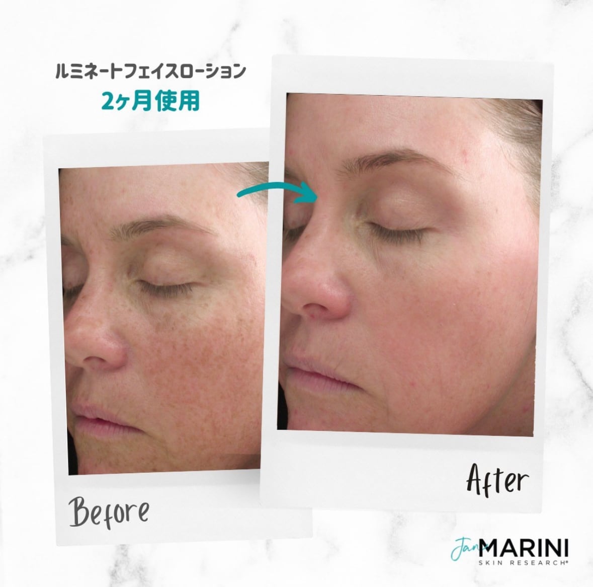 リピート】【美白】ルミネート フェイスローション（レチノール0.3