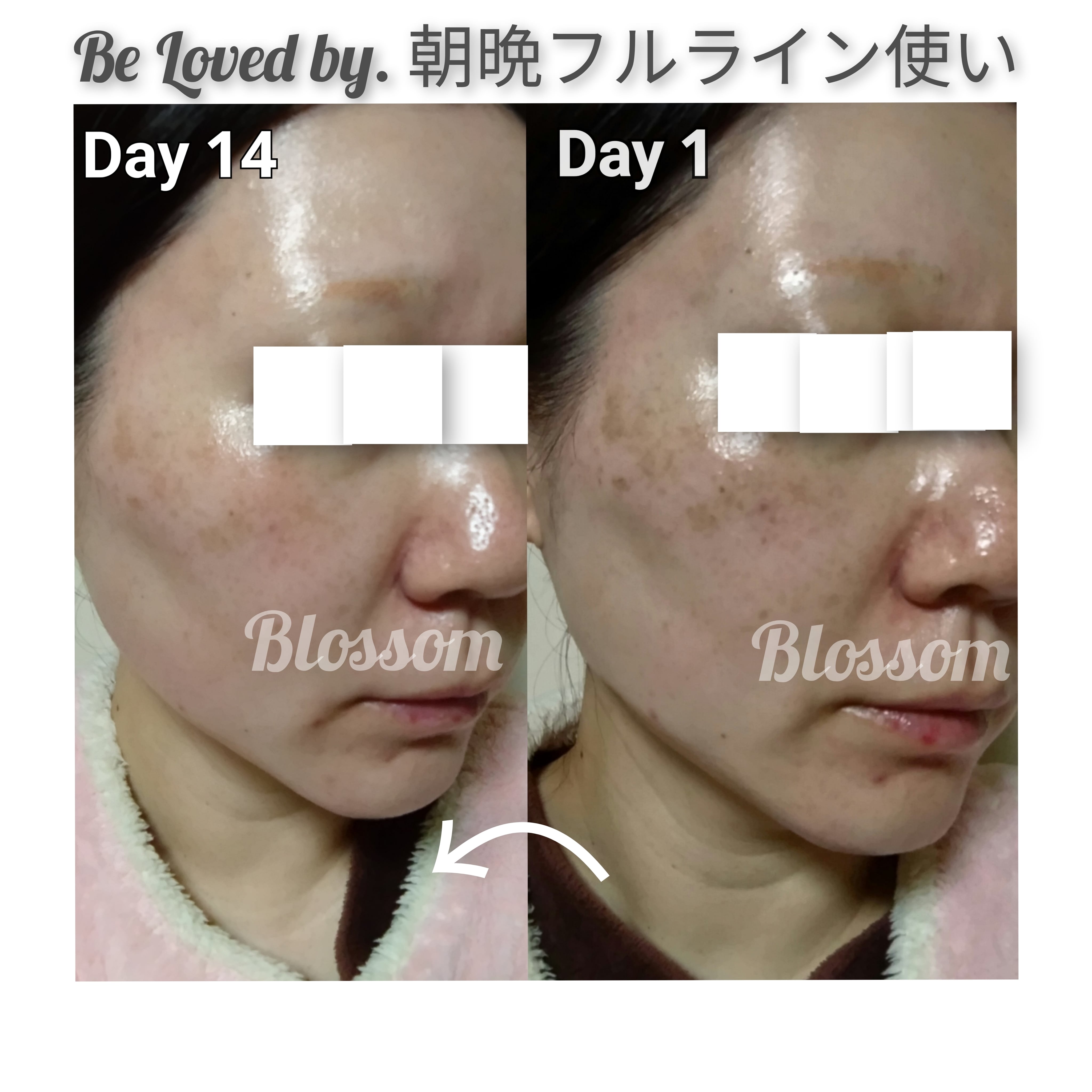 ⚿ビタミンCの172倍の抗酸化力♡ スキンセラムFL 美容液 60mL Be Loved