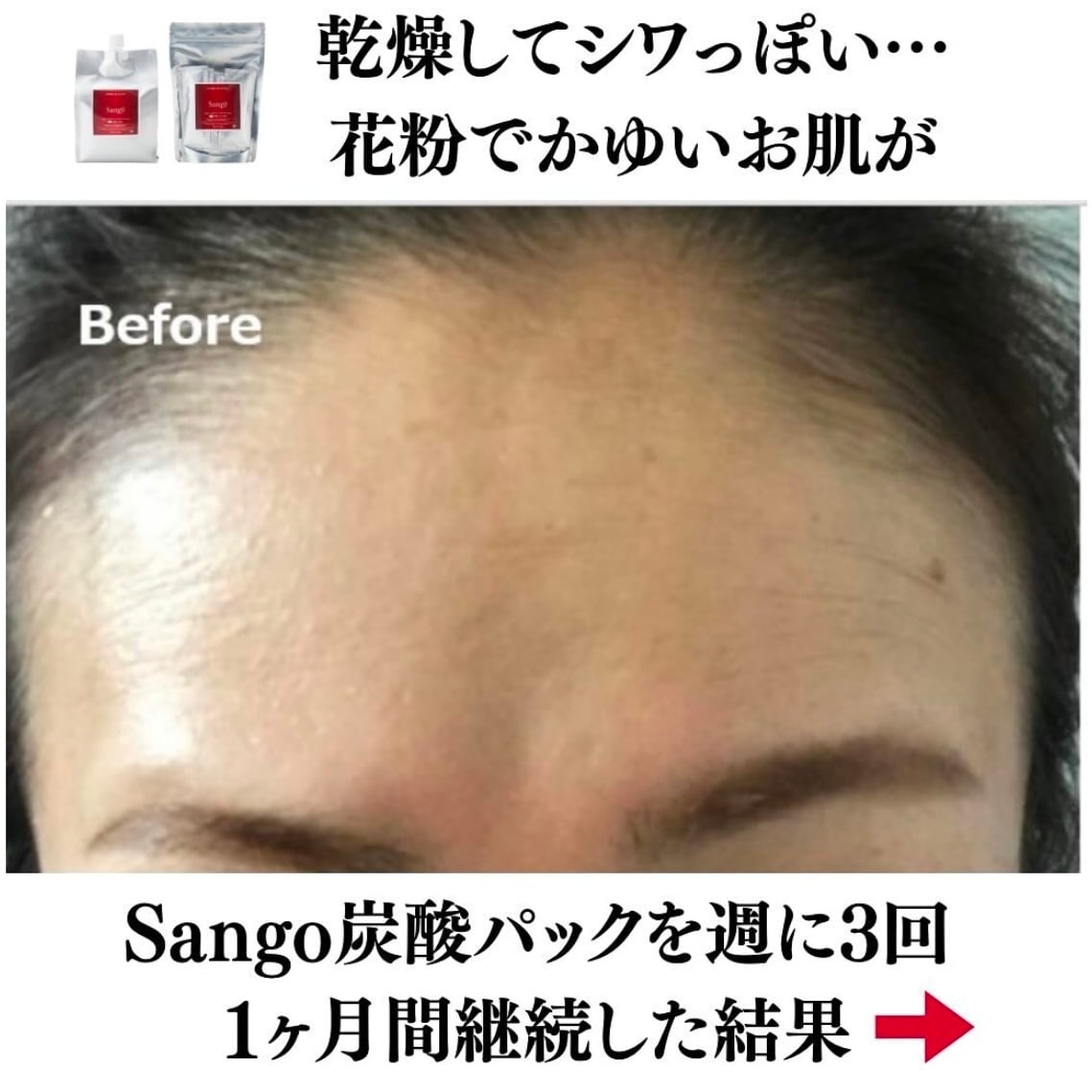 Sango】ダブルエナジーCO2ジェル5回分(高濃度炭酸パック) | nemuriselect