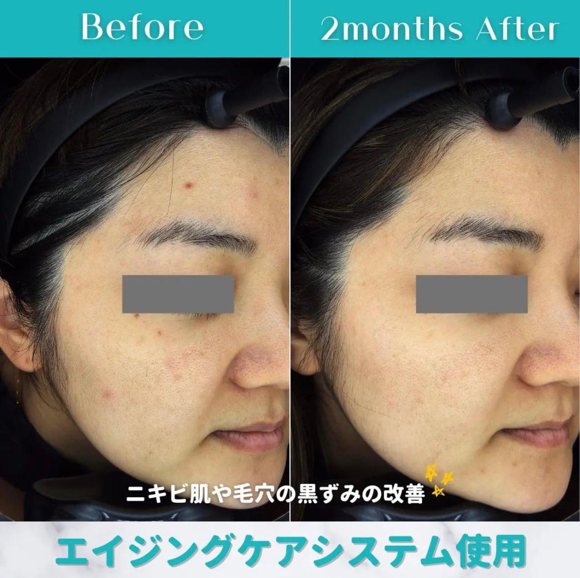 80b5ec5c6532bdfdc2822e651c20c8