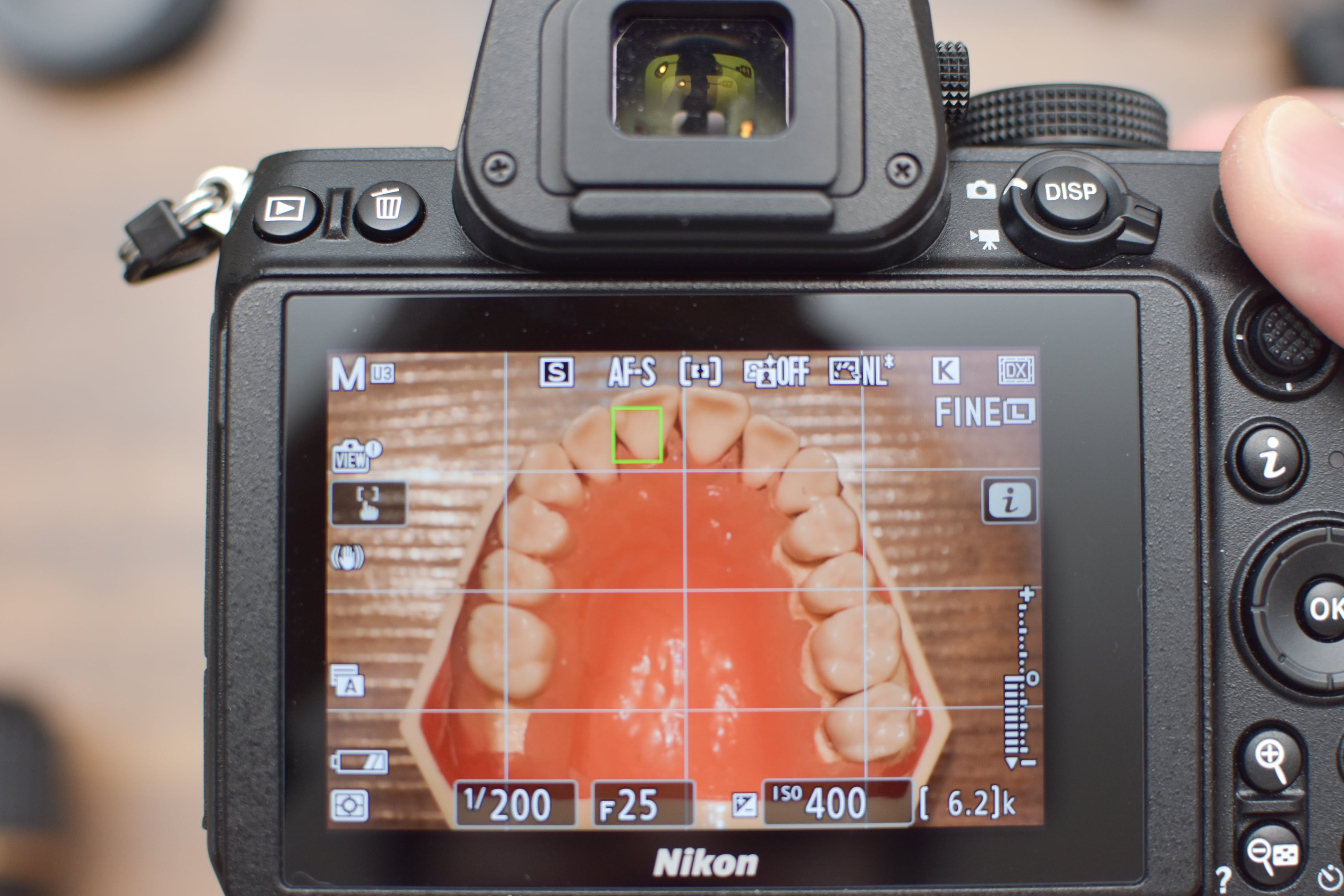 Pro TWIN II│Nikon Z30 | Dental Photo Nostalgista