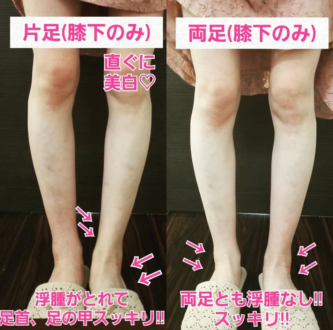 F.I.Rエクストラボディクリーム | バストケア専門サロンBonita