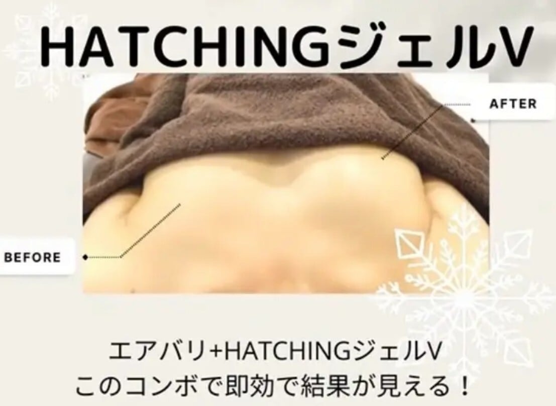 HBスリーナインパール【リニューアルジェルV】200g | Pay ID