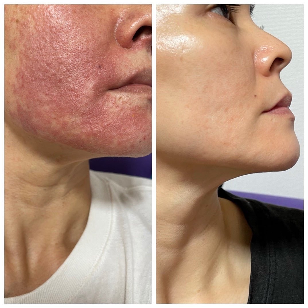 アズイリス 炭酸ガスパック | Pay ID