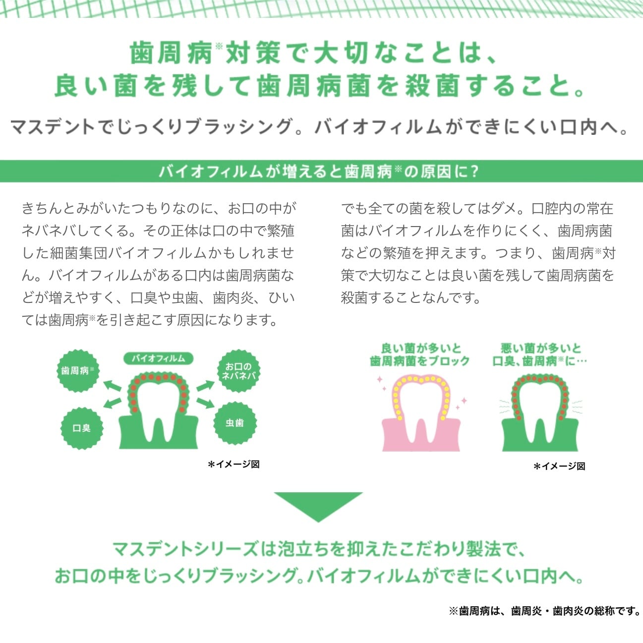 ゼリア新薬 マスデントケア 110g ☆ 歯周病や歯ぐきからの出血予防にマ