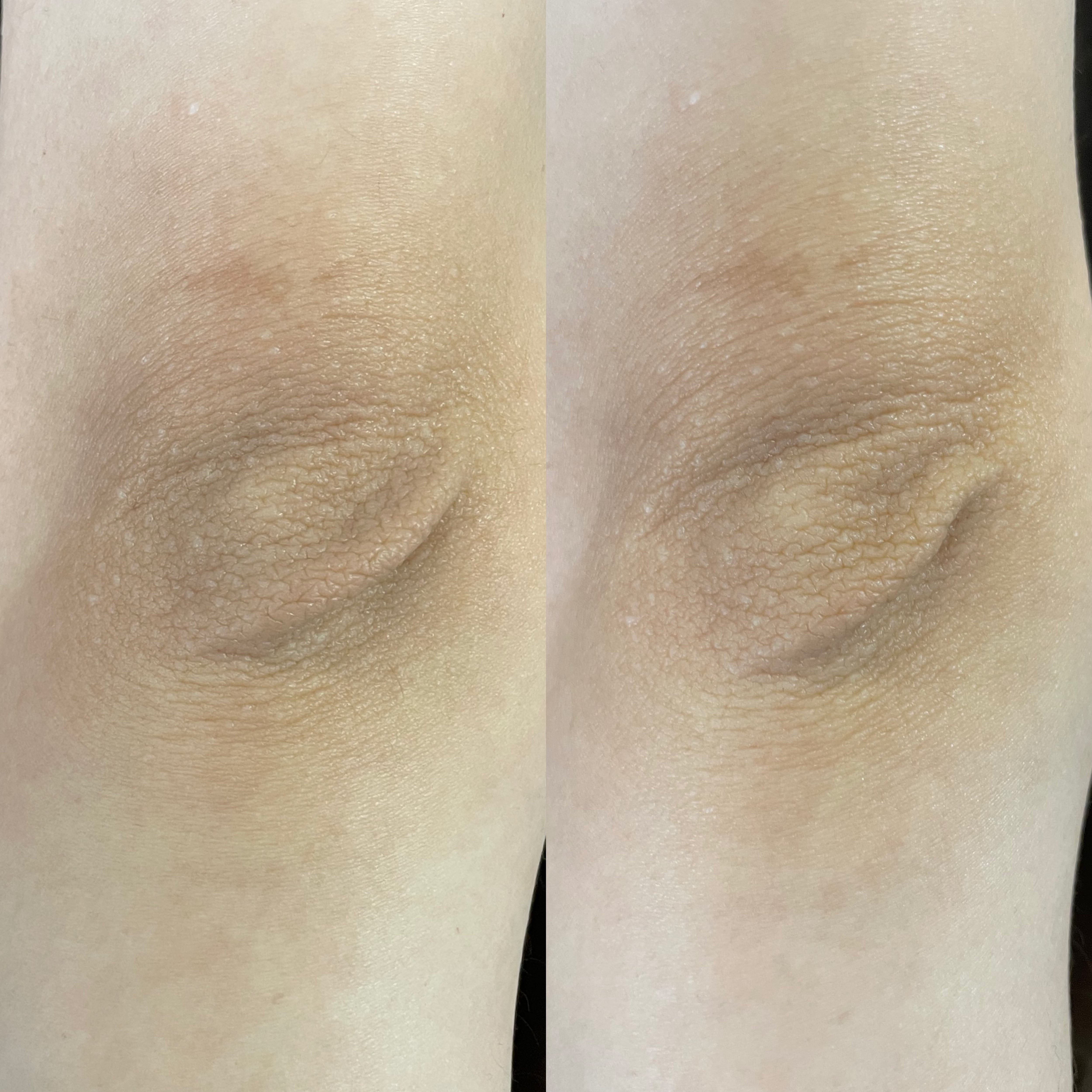 ローマピンク アフタークリーム ホワイトクリーム (ボディ用) | Pay ID